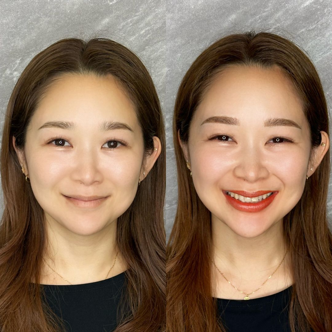 リップのアートメイクの症例写真